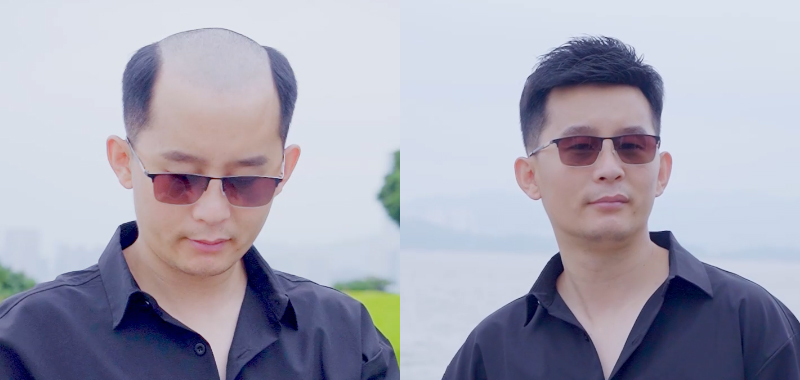男士假发案例视频