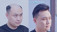 男士假发客户案例视频>>