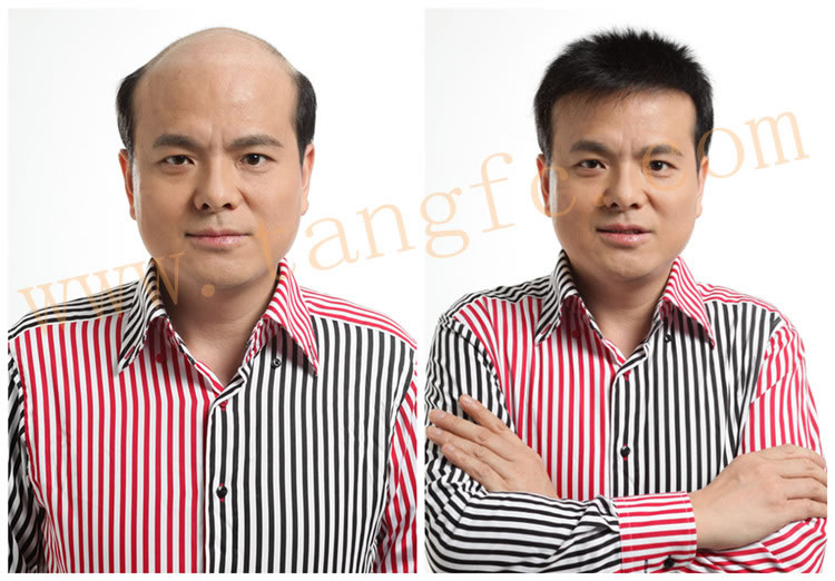 用什么洗头可以生发?