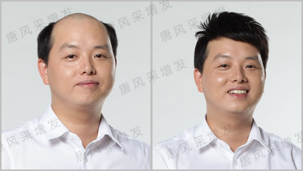 头发细软少,怎么让头发变硬?