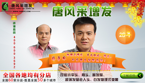 织发牌子 明星也织发,织发哪个牌子好?