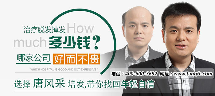 头顶头发稀疏怎么办？怎样可以防止脱发？