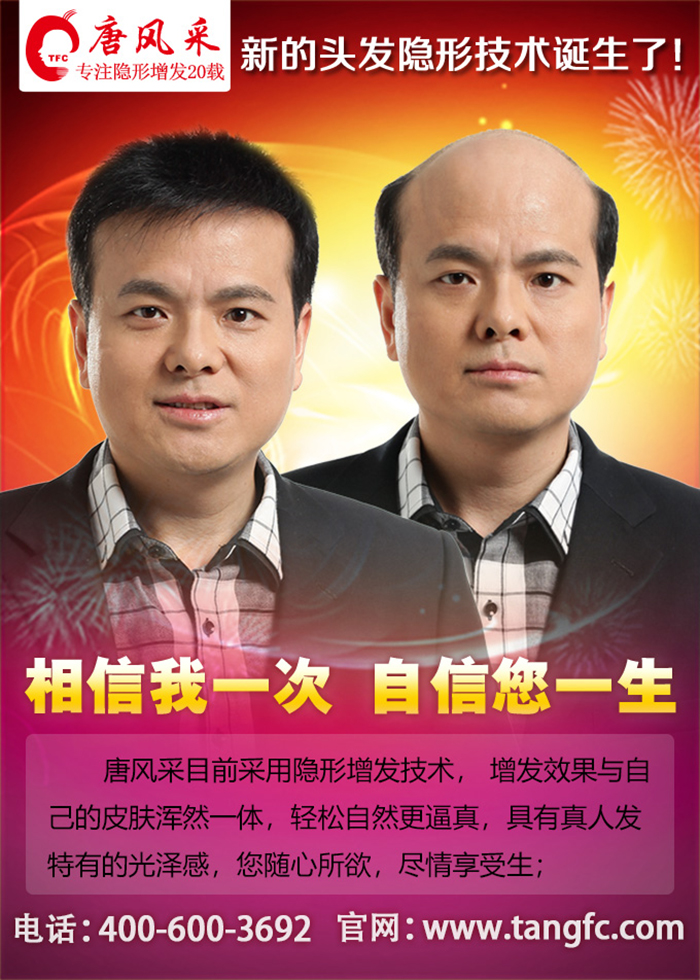 有点秃顶怎么办 有点秃顶怎么办,秃顶的原因你知道吗?