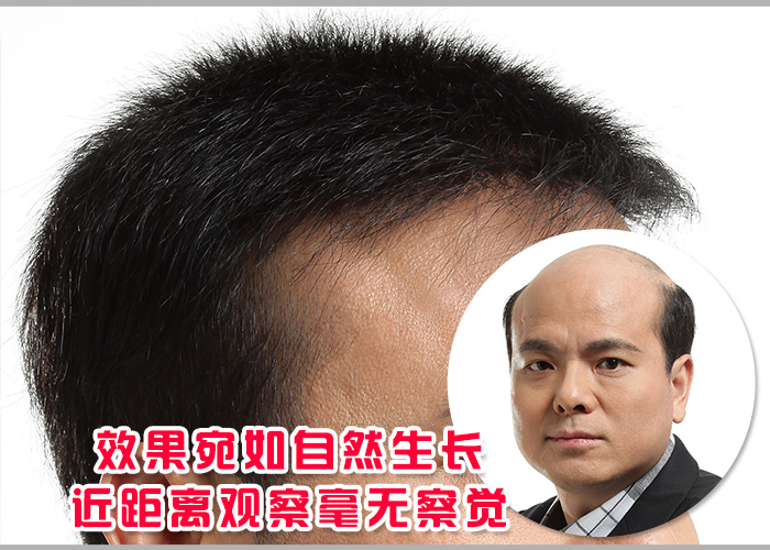 织发技术 一小时让头发乌黑浓密不是梦,织发新技术帮你实现!