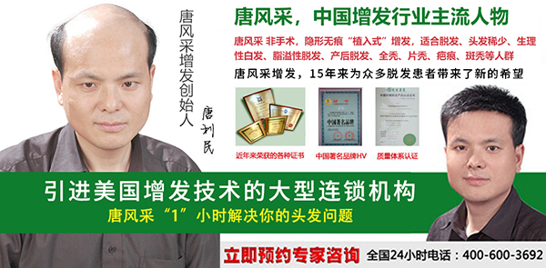早秃怎么办 早秃怎么办?哪里能进行男士头发加密?