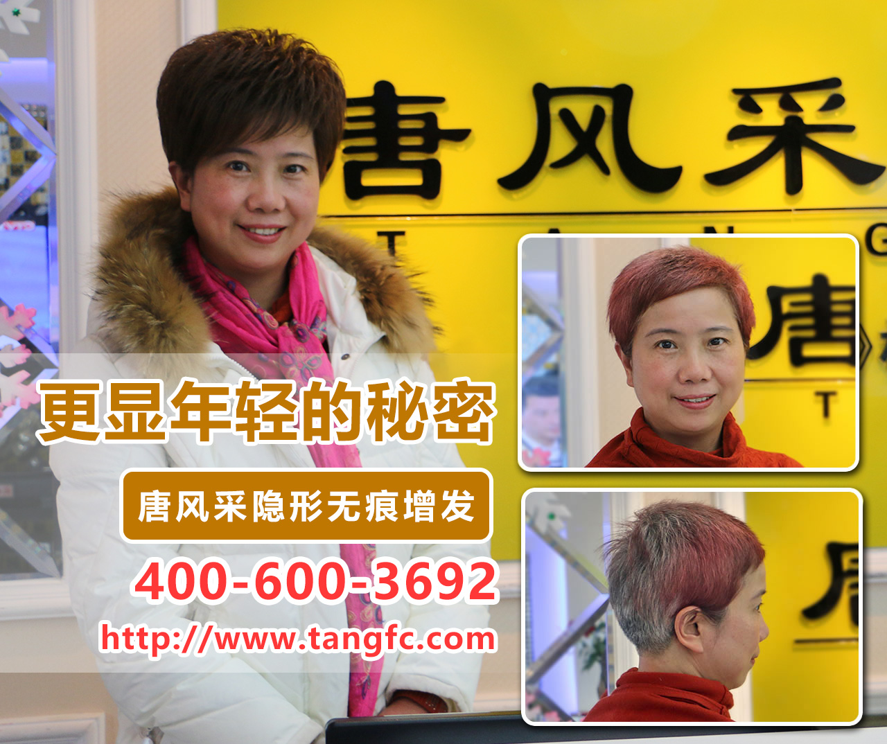 20岁就脱发 20岁就脱发怎么办?兰州专业补发哪家效果好?