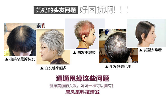 白发变黑技术 男子发帖抱怨过早白发,偶得白发变黑技术