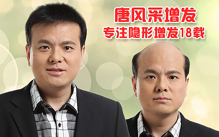 男士发型 哪种男士发型好看?掉头发怎么办