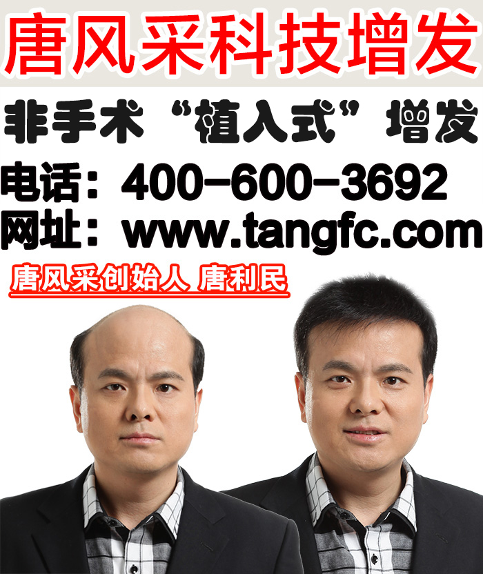 中年男士假发 真人发中年男士假发多少钱?中年人为何易秃
