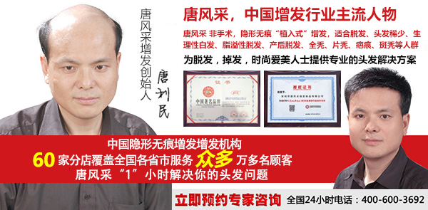 男士假发套 传统男士假发套和补发的区别,长期戴哪种更好?