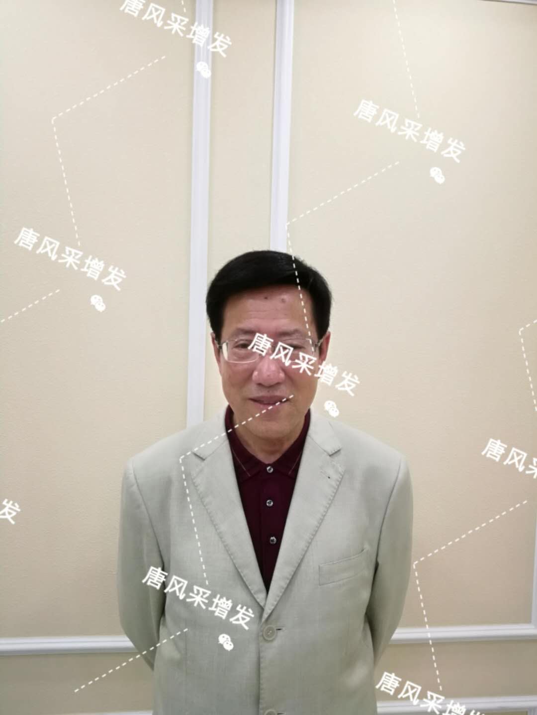 脱发秃顶成中年男人标配？唐风采增发让您风采始终如一