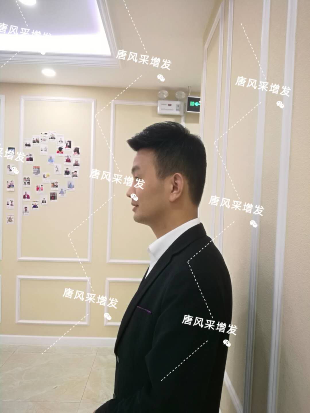 输了头发不能输气质 输了头发不能输气质,看帅哥的逆袭之路!