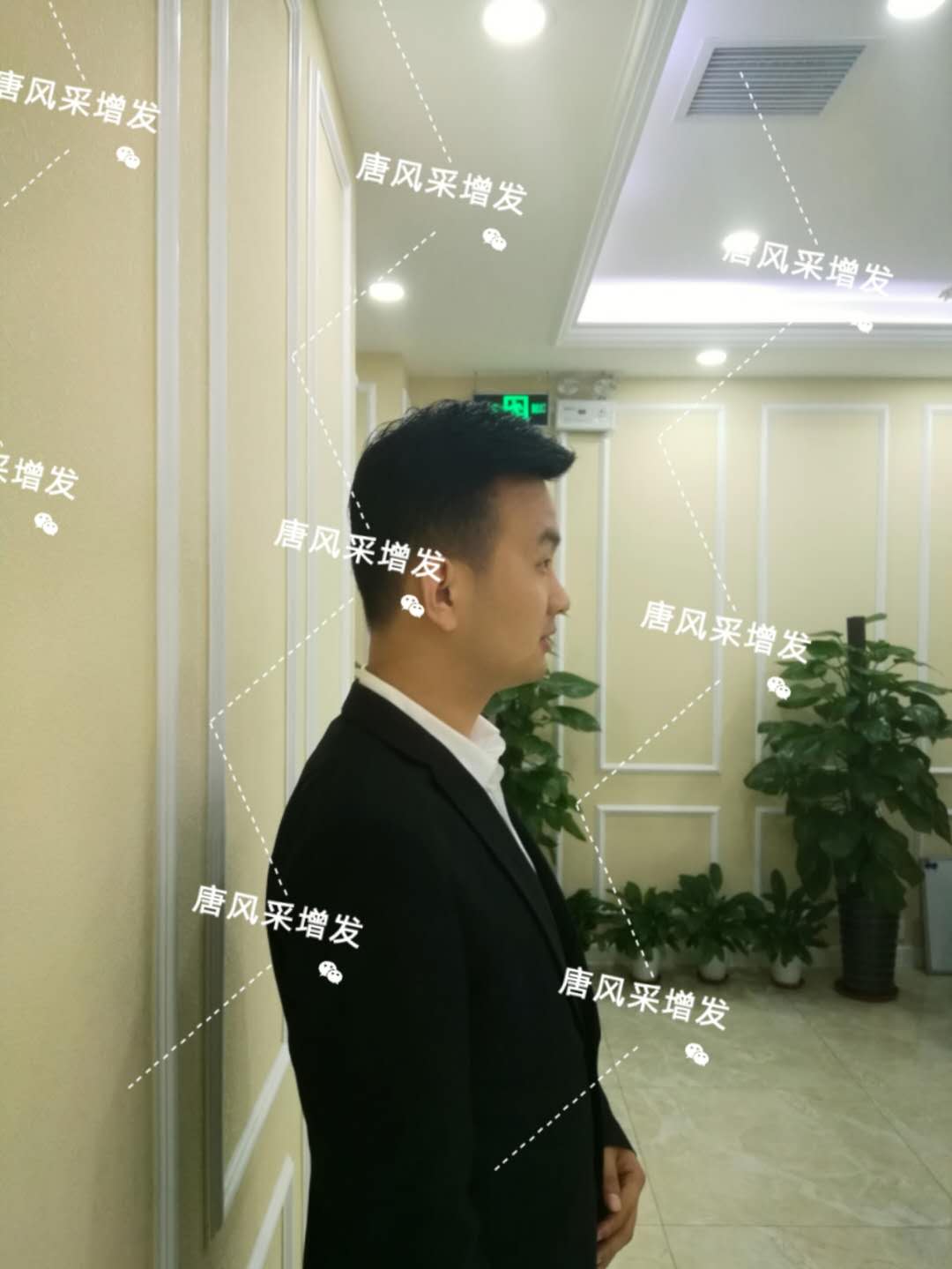 输了头发不能输气质 输了头发不能输气质,看帅哥的逆袭之路!