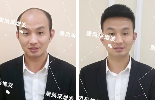 输了头发不能输气质 输了头发不能输气质,看帅哥的逆袭之路!