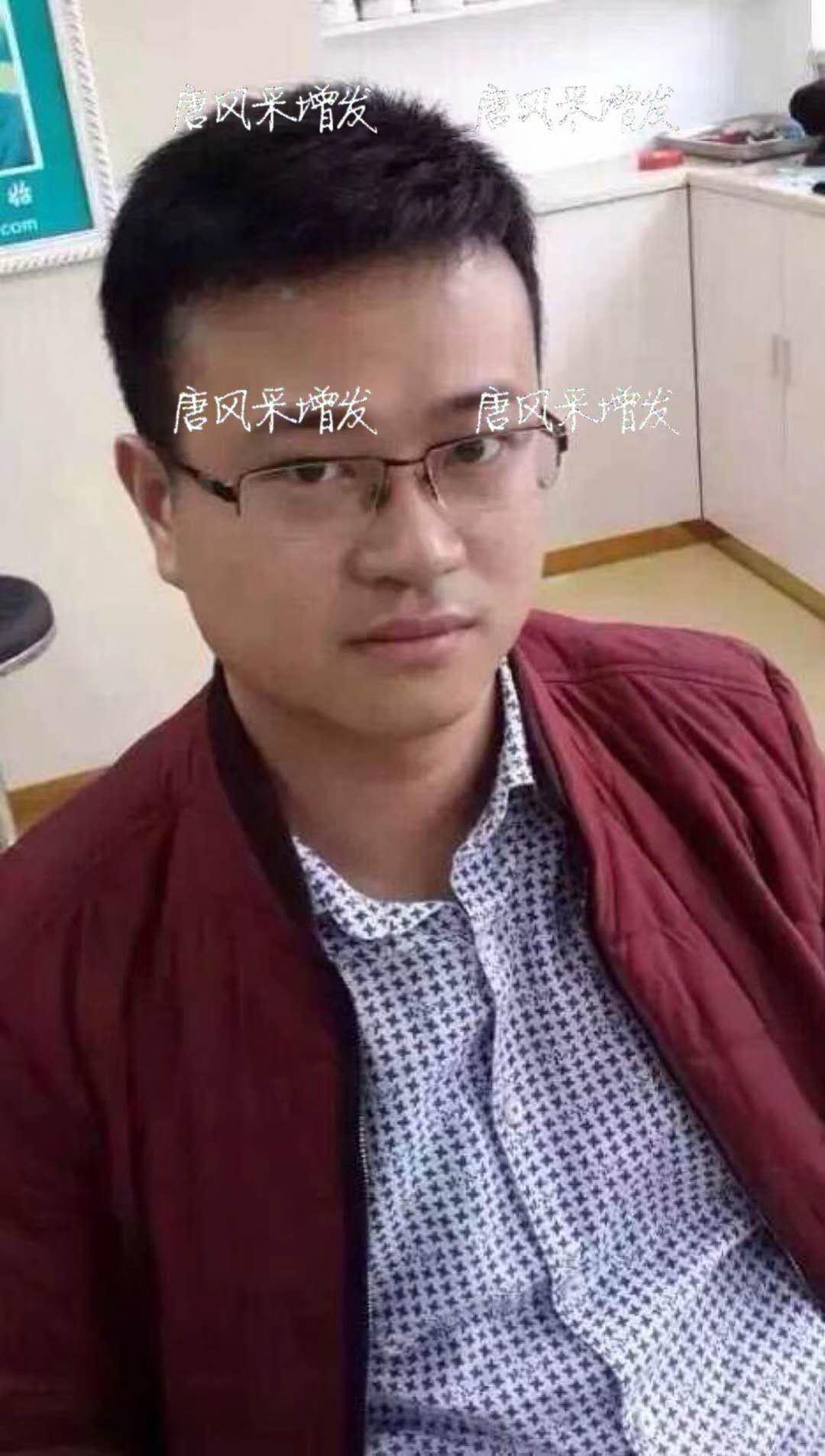  生发了这么久，但凡有效果的也该有些迹象了