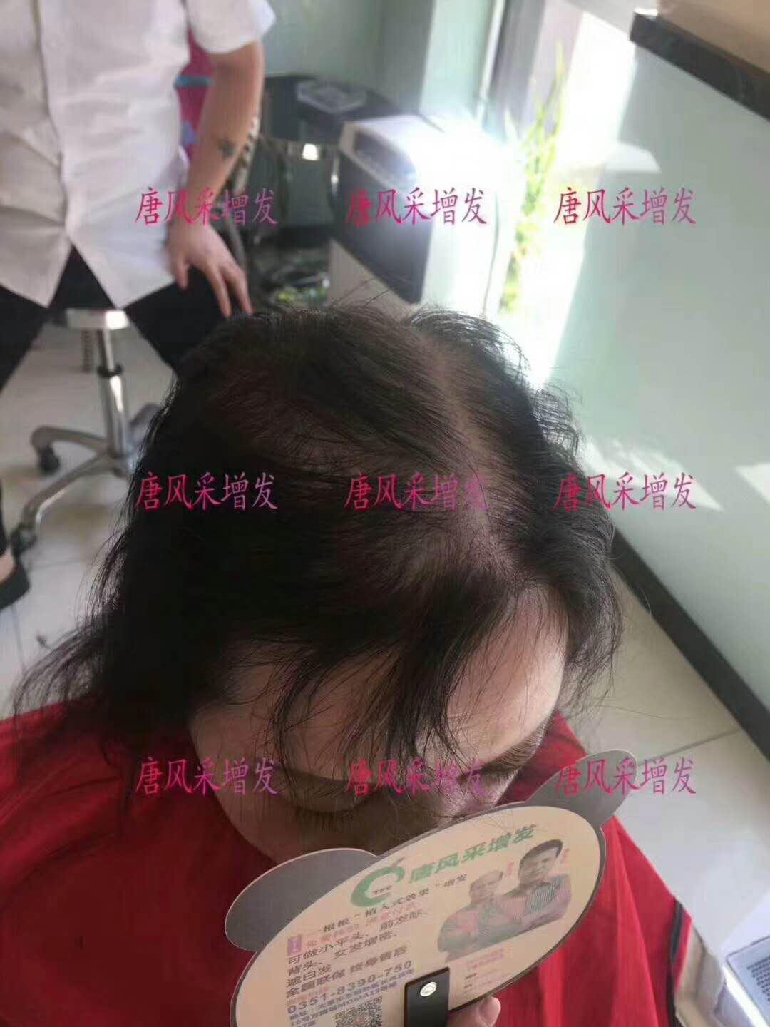 连美颜相机都无法拯救你的头发？但唐风采可以啊！