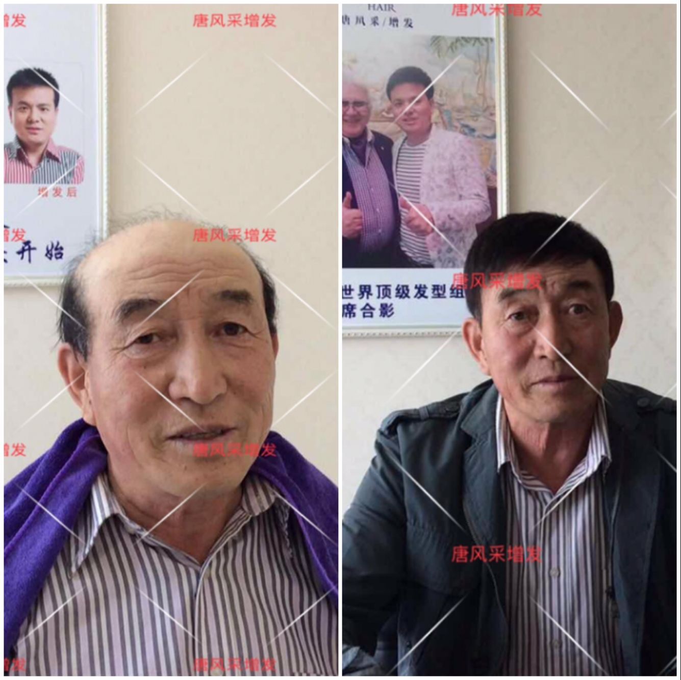增发 朝阳耿直大叔2年内苦寻三次唐风采增发,2018终于不虚此行
