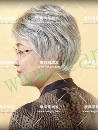 光秃秃 脱发 光秃秃的院子光秃秃的头,与其羡慕不如改变!
