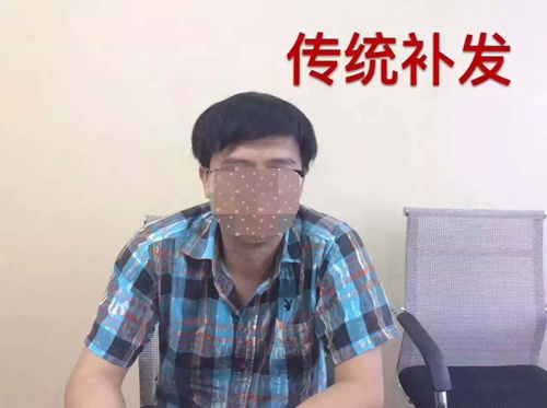 西宁卖假发的地方,假发专卖店 一般假发案例