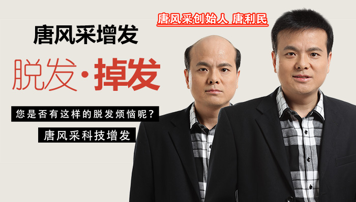 秃顶发型设计 唐风采增发