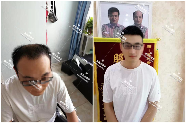 头顶局部假发 唐风采假发可以戴着打球和游泳