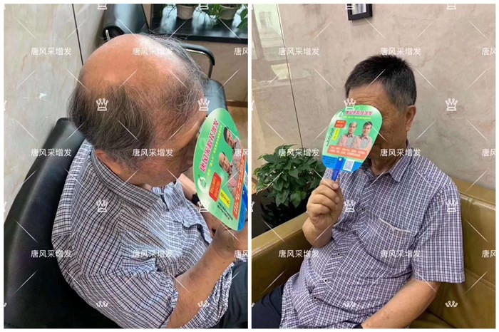 设计匹配的中老年男士假发