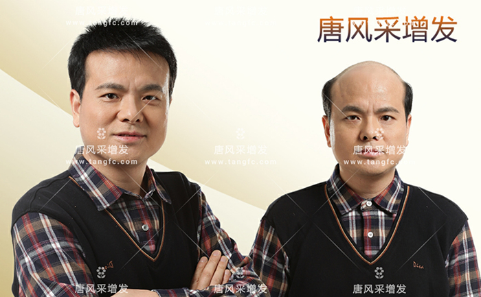 北京卖假发的地方 \
