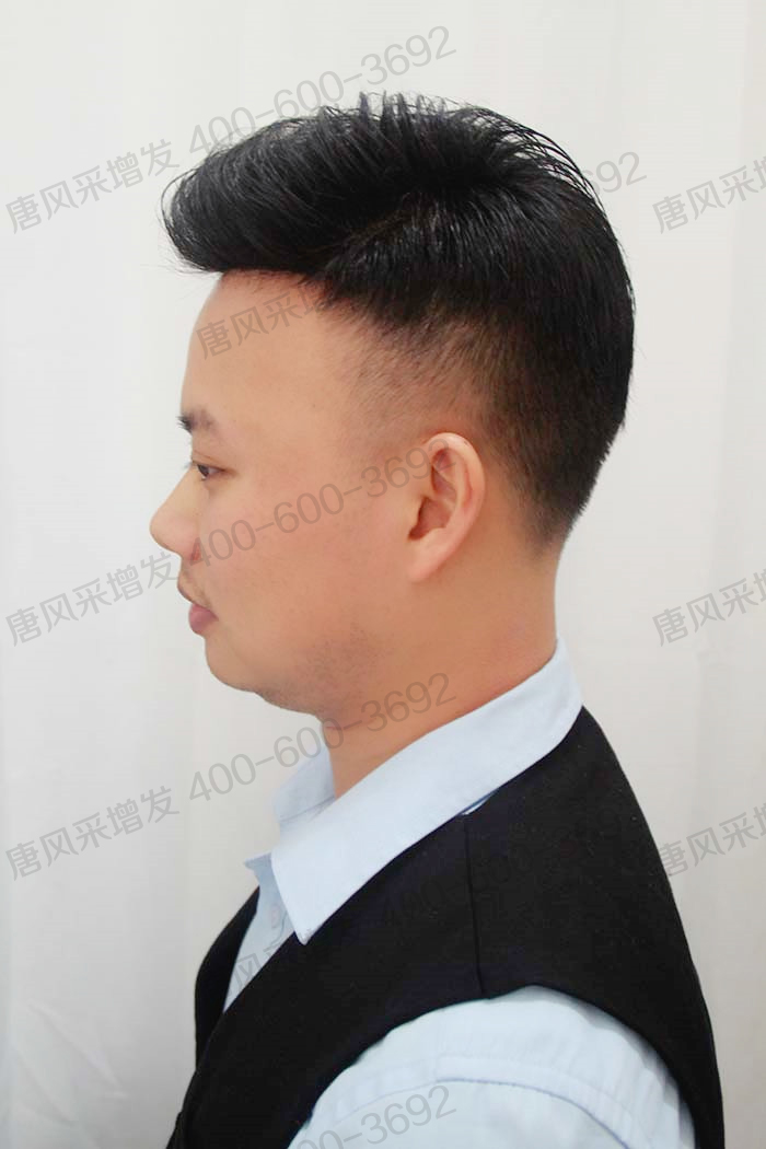 男士假发块粘贴佩戴 \