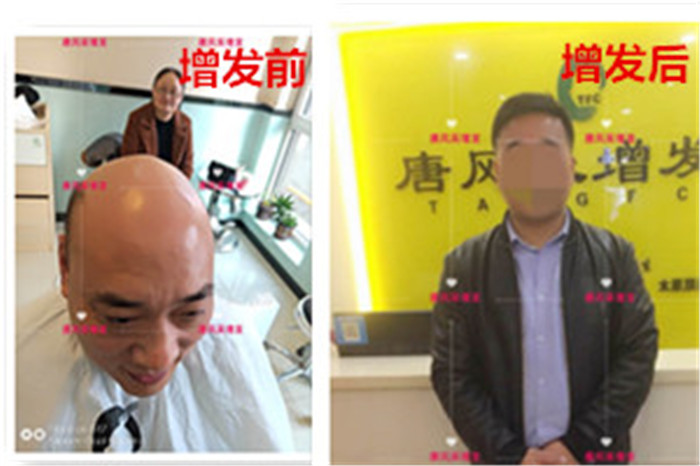 光头男士可以带头套吗 \