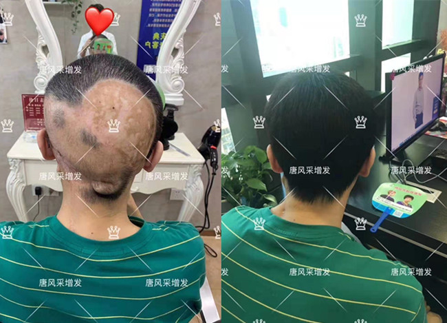 光头男士可以带头套吗 \