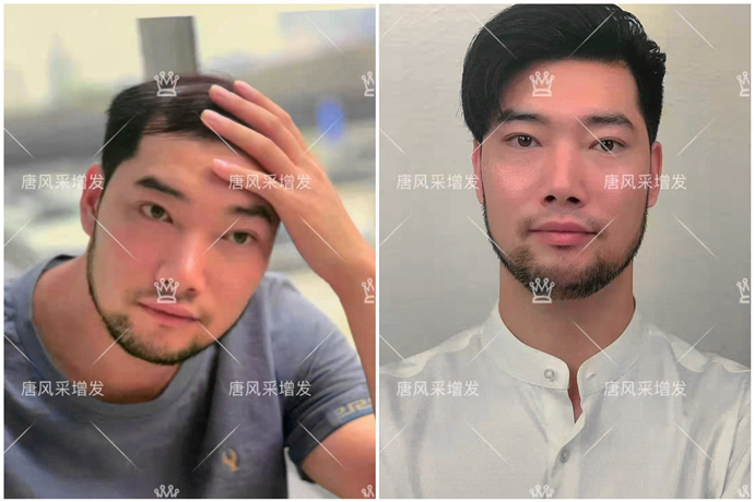 定制发块 \