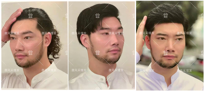 定制发块 \