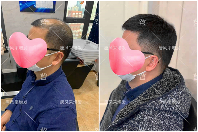 男士买假发 \