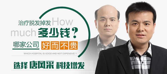 男士买假发 \