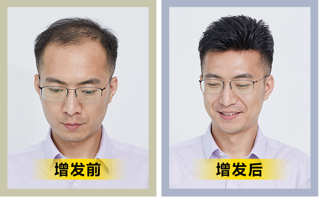纯手工真人发套 \