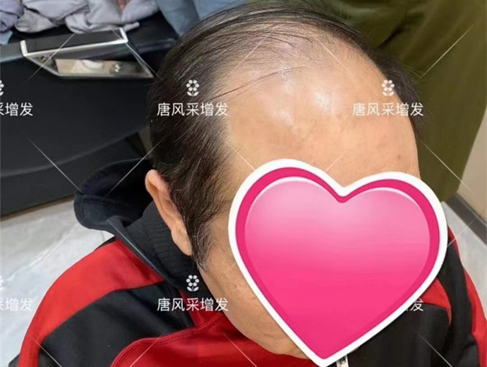 男士潮流假发 \