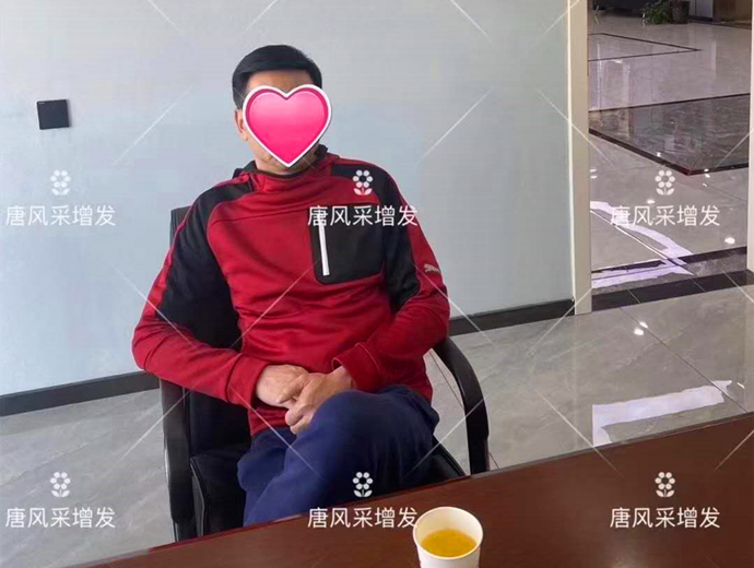 男士潮流假发 \