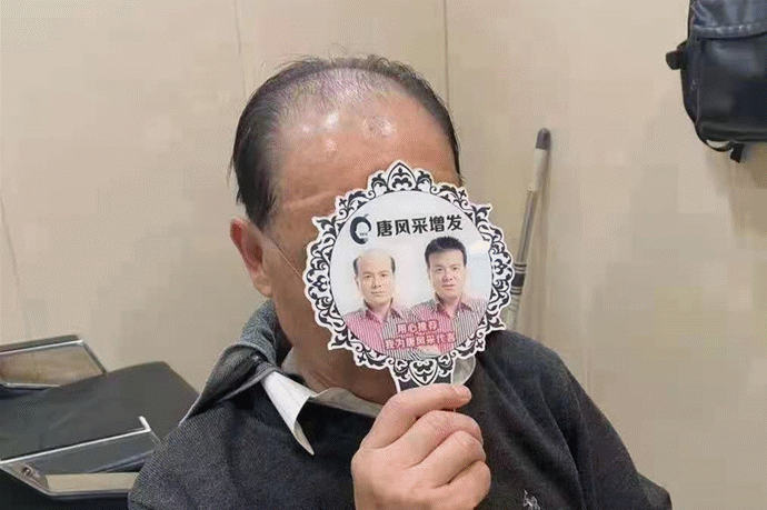 隐形补发 \