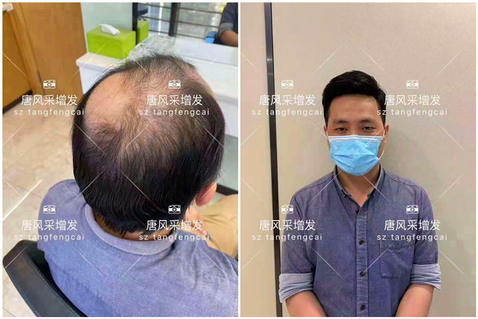 男士夏天戴假发 \