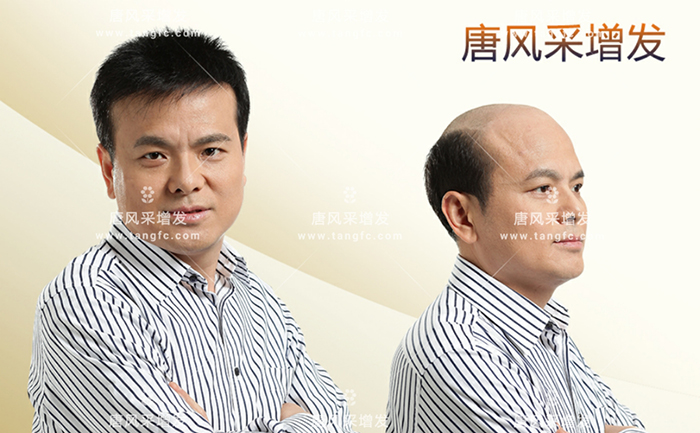 男士夏天戴假发 \