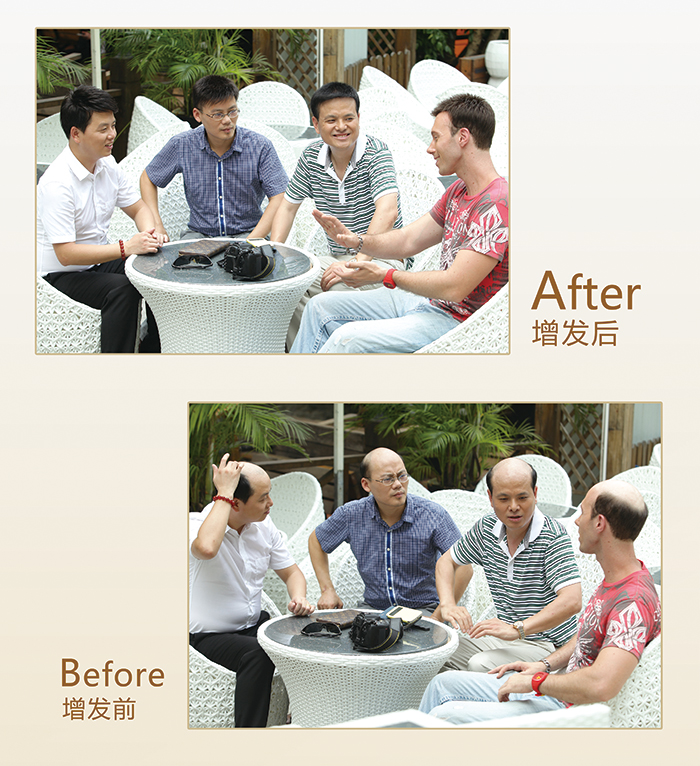 用自己头发做假发 \