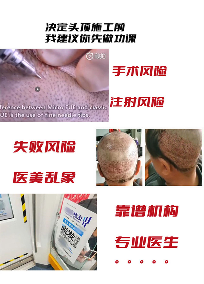 品牌男士假发 \