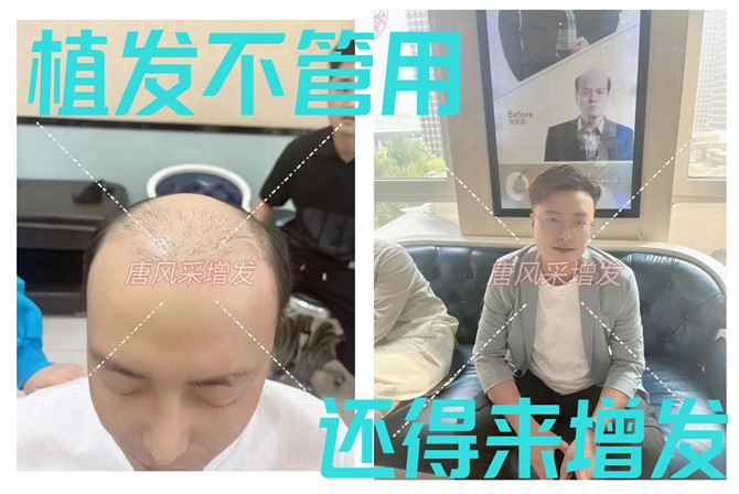 品牌男士假发 \