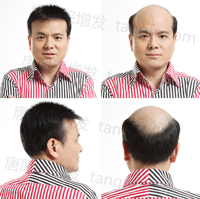 仿真男士补发 \