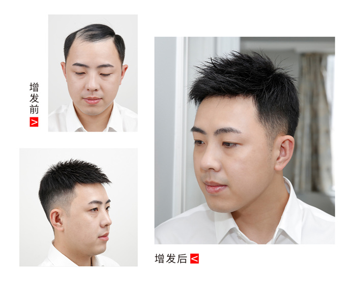 假发片怎么买 \