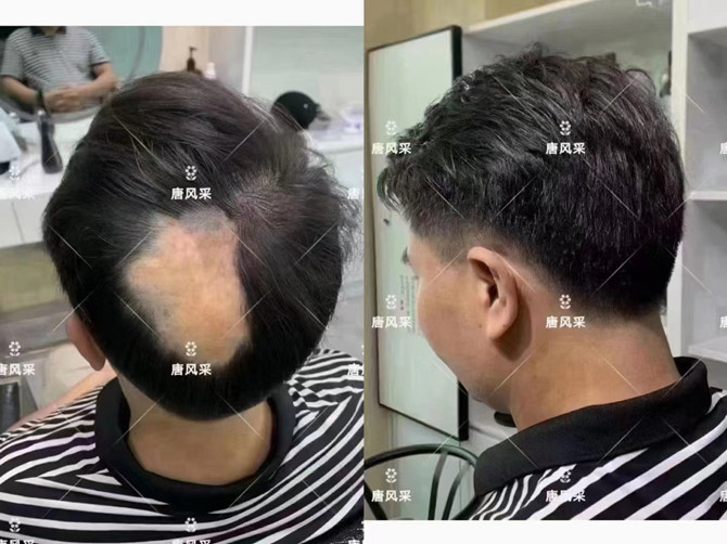 仿真头发假发片 \