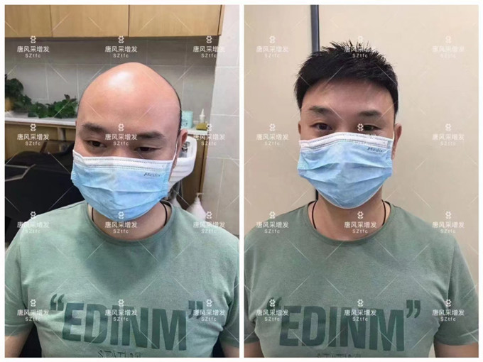 仿真头发假发片 \