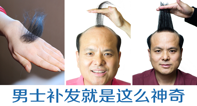 假发定制哪家最好 \