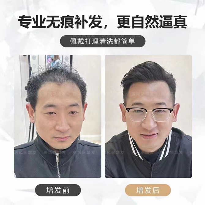 假发块粘贴佩戴技巧 \