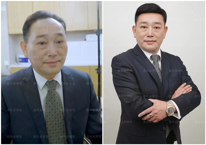 假发块粘贴佩戴技巧 \